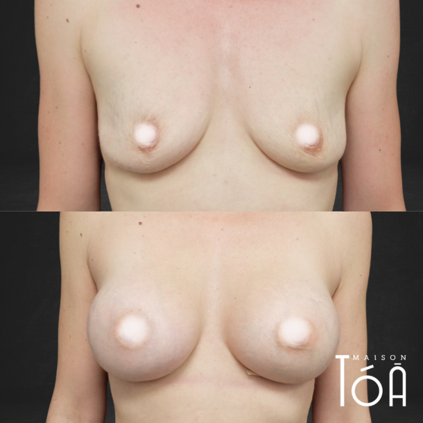 1 1