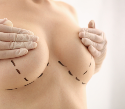 augmentation mammaire lausanne