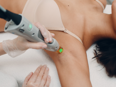 Epilation Laser